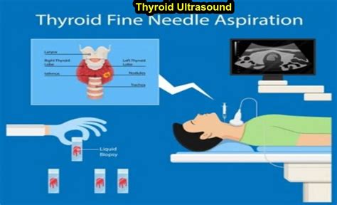 Thyroid Ultrasound Purpose, Procedure & abnormal 24