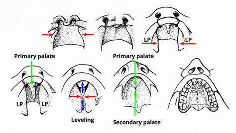 Development Of Palate Anatomy QA, 53% OFF | gbu-hamovniki.ru