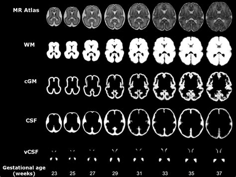 Atlas of mri brain anatomy apk – Telegraph