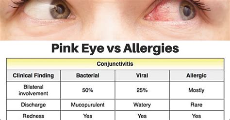 Pink Eye vs. Allergies : Causes of Pink Eye [Infographic]