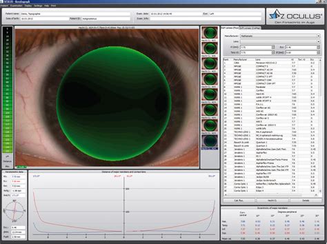 Contact Lenses — Meadows Vision Center