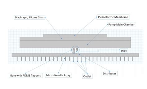 Evaluating an Insulin Micropump Design for Treating Diabetes | COMSOL Blog