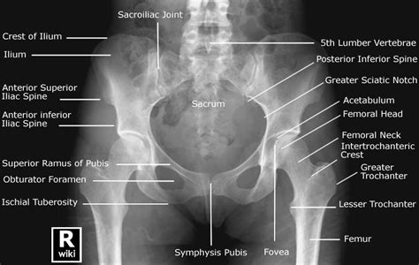 Pelvis Radiographic Anatomy | Medical anatomy, Radiology student, Medical knowledge