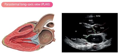 Standard Transthoracic Echocardiogram: Complete Imaging Protocol – Cardiovascular Education