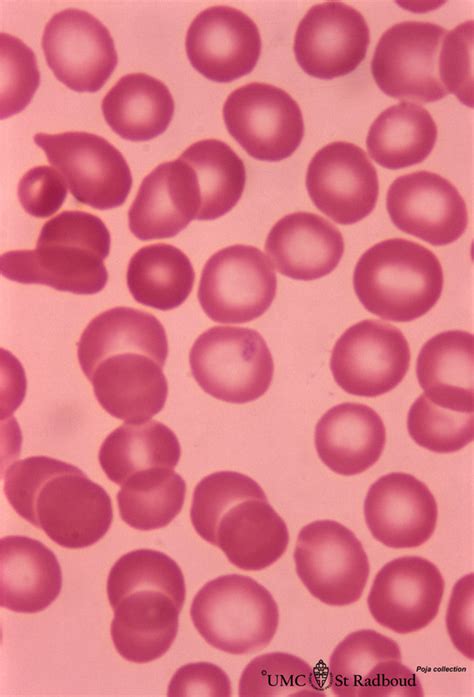 Erythrocytes in peripheral blood smear (human) - POJA Collection Microscopic Anatomy