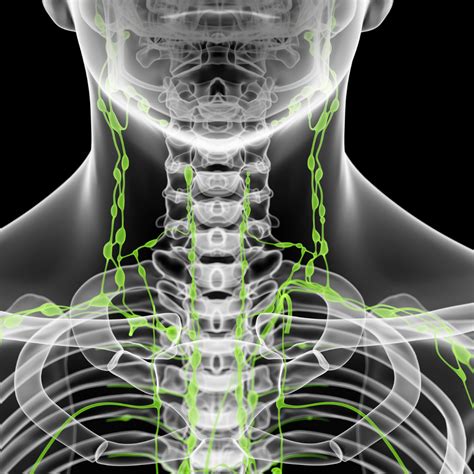 Swollen Lymph Nodes In Neck