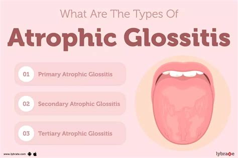 Atrophic Glossitis: Causes, Symptoms, Treatment and Cost