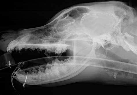 Jaw Fractures | Clinician's Brief