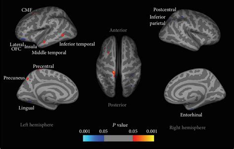 Figure 1 from Molecular and Functional Imaging of Internet Addiction | Semantic Scholar