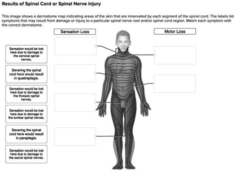 Quadriplegia Symptoms List Of Signs Of Quadriplegia