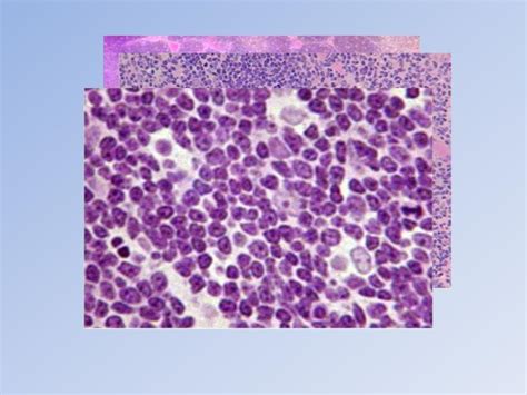 PPT - Thymus and Thymoma PowerPoint Presentation, free download - ID:429921