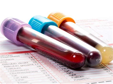 Hypoalbuminemia: Causes, treatment, and symptoms