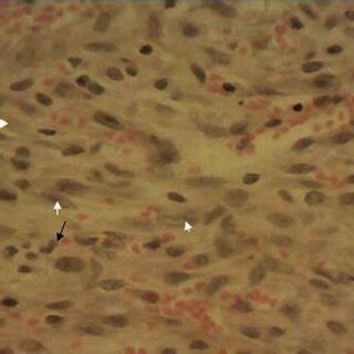 Photomicrograph of the skin biopsy with observed changes in the control... | Download Scientific ...