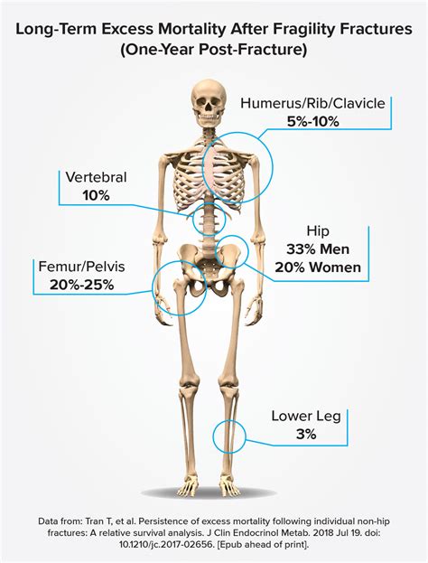 Osteoporosis Fracture Recovery