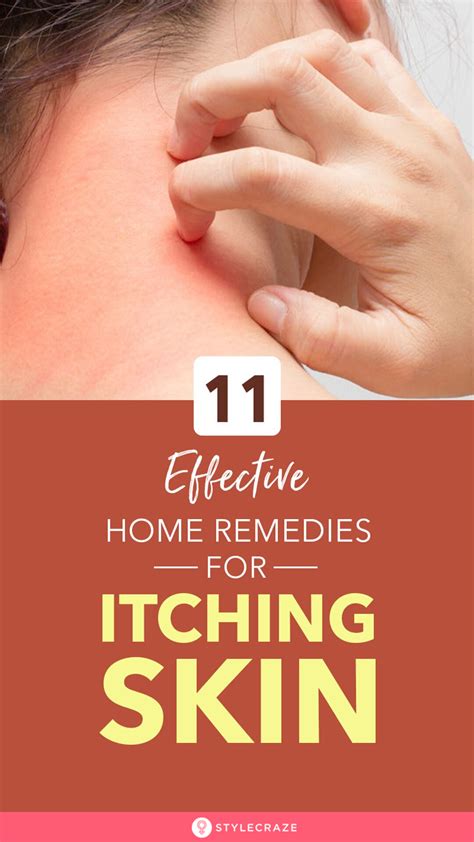 Itchy Skin Face, Skin Rashes That Itch, Soothe Itchy Skin, Itching Skin Remedies, Dry Itchy Skin ...