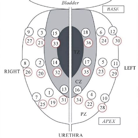 Prostate Biopsy Zones