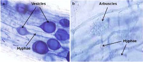 Microscopic visualization of arbuscular mycorrhizal fungi (a) showing... | Download Scientific ...