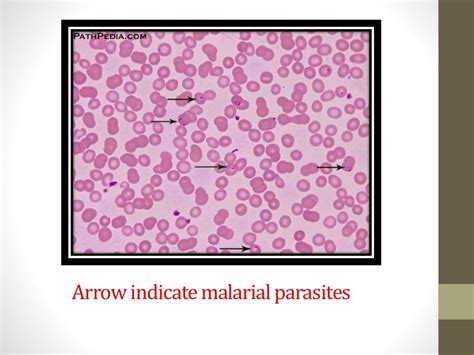 Blood smear staining