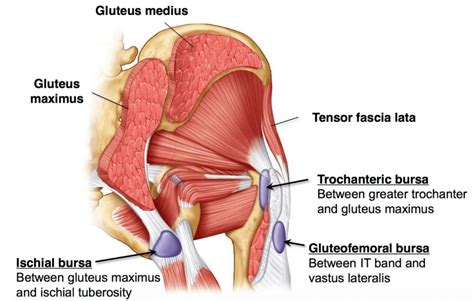 Trochanteric Hip Bursitis Treatment in NYC | NYDNRehab