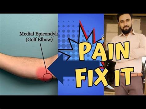 treatment, stretches and exercises for golfers elbow, medial epicondyle pain, medial ...