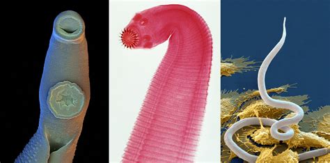 Why I'm Fascinated By Parasitic Worms | Health News Florida