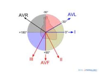 ECG (EKG) Interpretation - Oxford Medical Education