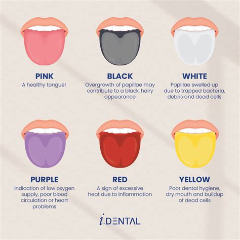 Normal Healthy Tongue Color