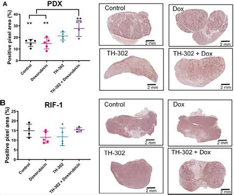 Quantification and representative images of pimonidazole staining in ...