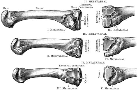 Metatarsal bones; Metatarsals