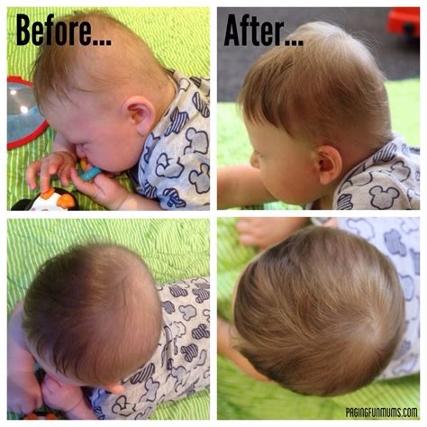 Putting the 'Play' in Plagiocephaly (pla•gi•o•ceph•a•ly) - Paging Fun Mums