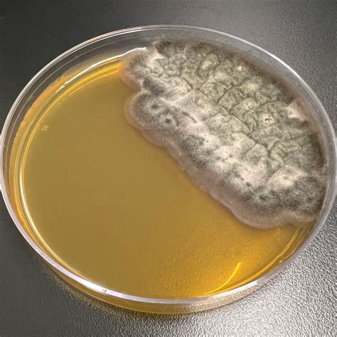 Stachybotrys chartarum | Microchem Laboratory