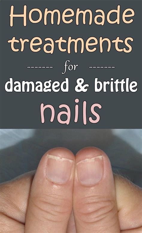 Homemade treatments for damaged and brittle nails | Brittle nails ...