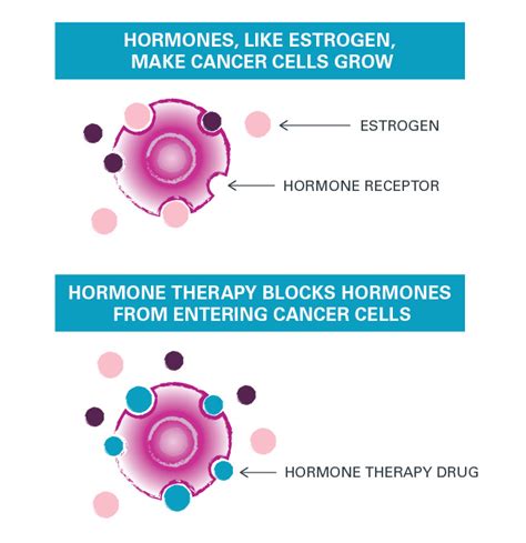 Breast cancer study tests pairing hormone therapy with immunotherapy | Nebraska Medicine Omaha, NE