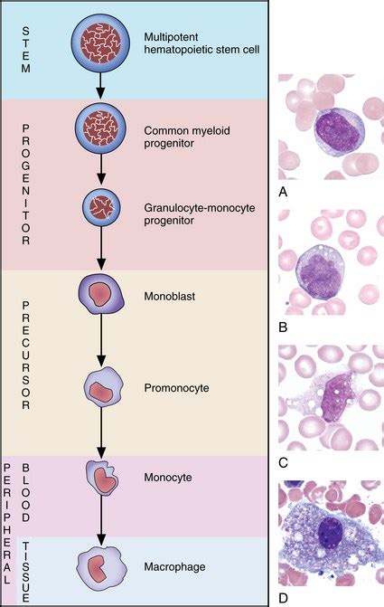 Muhammad Ahmad, MD on Twitter: "Monocytes vs promonocytes vs monoblasts: Monocyte: lacy ...