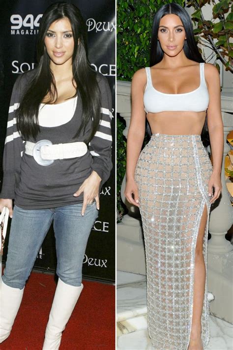 Kim Kardashian before and after: Experts have their say on speculated ...