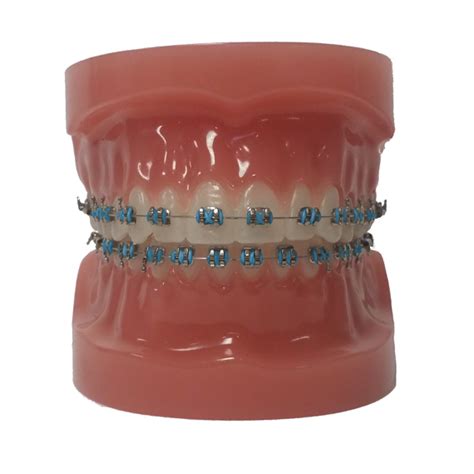 Customize Your Colors - North Portland Orthodontics - Oregon - Dr ...