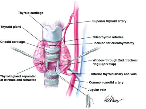 Cricothyroidotomy Anatomy