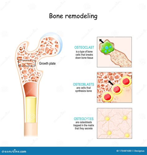 Osteocyte Cartoons, Illustrations & Vector Stock Images - 89 Pictures to download from ...