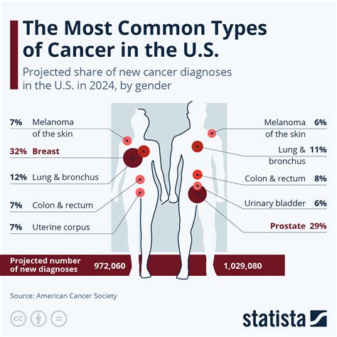 Chart: The Most Common Types of Cancer in the U.S. | Statista