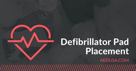 Defibrillator Pad Placement - Where Do Electrode Pads Go?