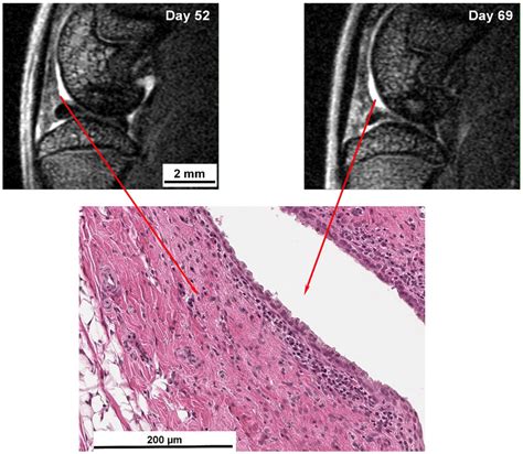 Hypertrophy of the synovial membrane induced by MSU/LPS. MRI images of ...