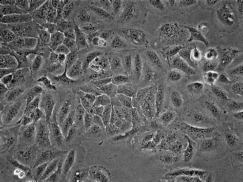 AddexBio Product Detail - HaCaT Cells