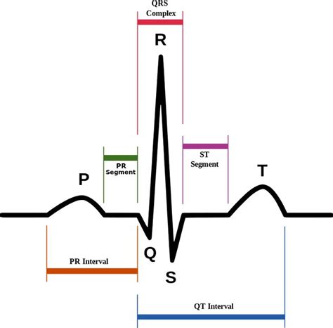 PR interval | Pr interval, Medical library, Ekg interpretation