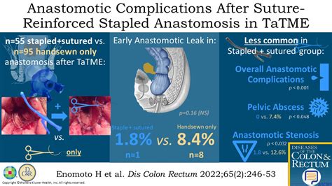 Anastomosis-Related Complications After Stapled Anastomosis... : Diseases of the Colon & Rectum