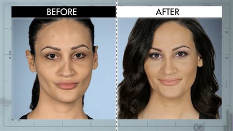 A Nose Shaped Like California from Botched Patients Before and After ...