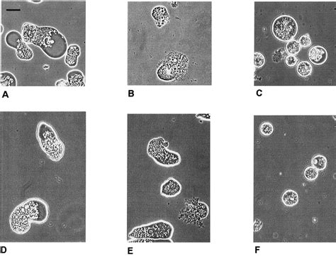 Phase-contrast microscopy showing the effect of treatment for 16 h with ...