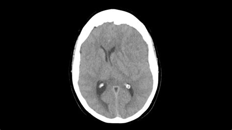 ct scan near me government hospital - Kermit Christie