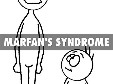 Marfan Syndrome by Tristan Kalina