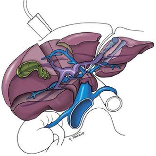 (PDF) Illustrative Couinaud Segmentation for Ultrasound Liver Examinations