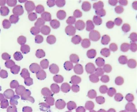 Diff Quick stained blood slide of the cat affected with Haemobartonella... | Download Scientific ...